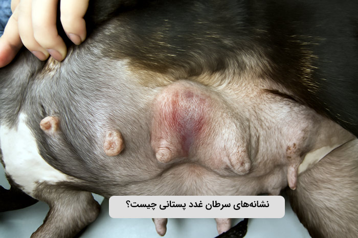 نشانه‌های سرطان غدد پستانی چیست؟