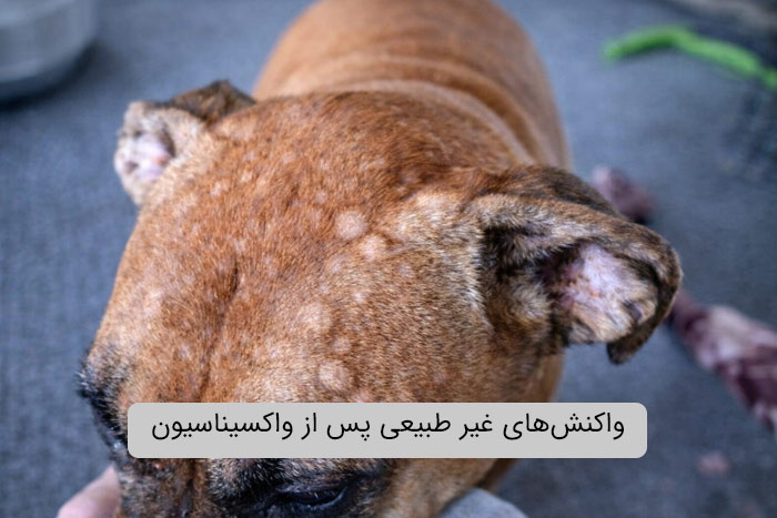 واکنش‌های غیر طبیعی پس از واکسیناسیون 